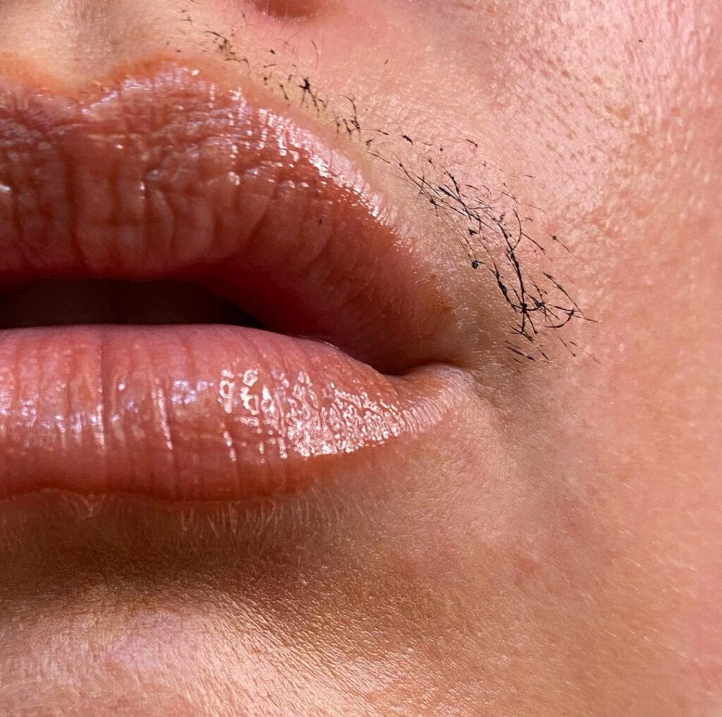 Facial: चेहरे के अनचाहे बालों को हटाने के लिए अपनाएं ये घरेलू नुस्खे