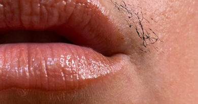 Facial: चेहरे के अनचाहे बालों को हटाने के लिए अपनाएं ये घरेलू नुस्खे