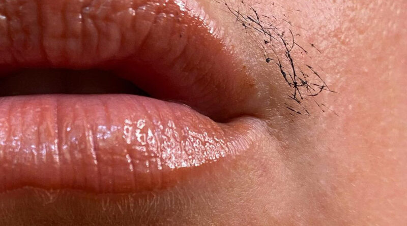 Facial: चेहरे के अनचाहे बालों को हटाने के लिए अपनाएं ये घरेलू नुस्खे