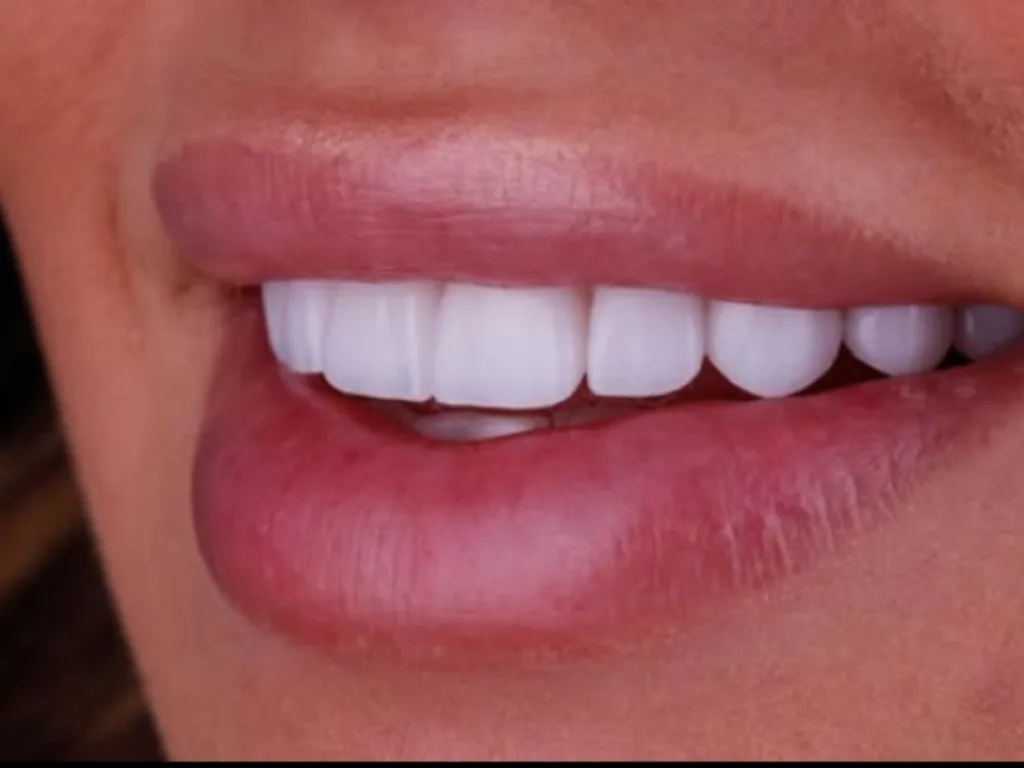 Teeth Remedies: दांतों के पीलेपन को दूर करने के लिए घरेलू नुस्खे