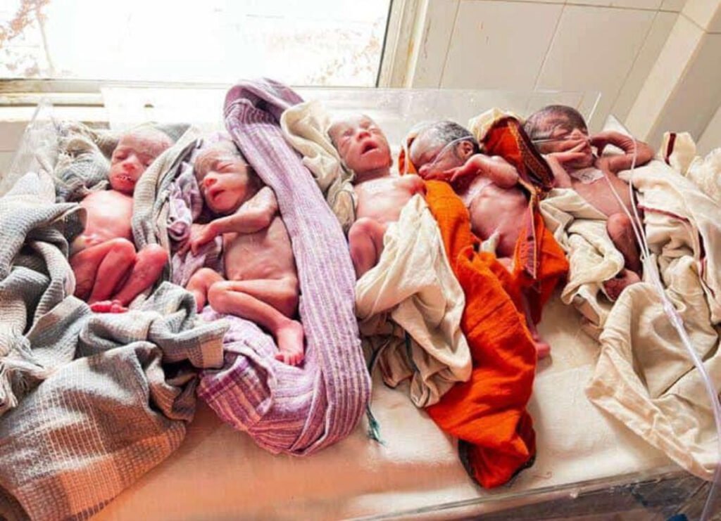 Woman Five: महिला ने एक साथ पांच बच्चों को दिया जन्म
