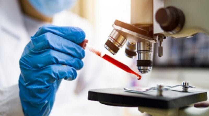 crimean congo hemorrhagic fever: हर दूसरे मरीज की होती है मौत