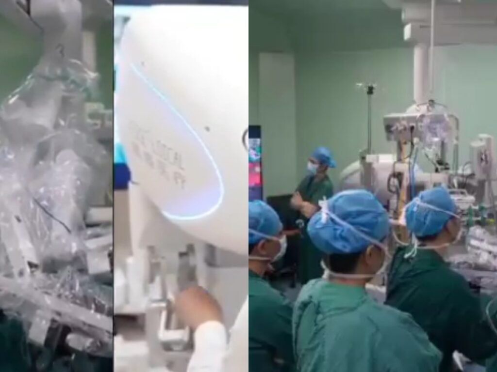 Doctor ने 5000 किलोमीटर दूर से किया मरीज के Lung का सफल ऑपरेशन